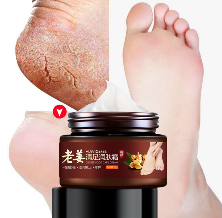 Buy Old ginger to get wet and stop itching peeling ulceration blister