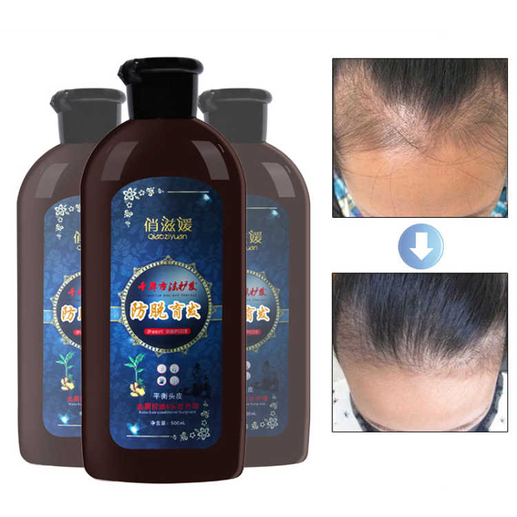 Buy Chinese herbal formula hair loss antihair loss seborring hair
