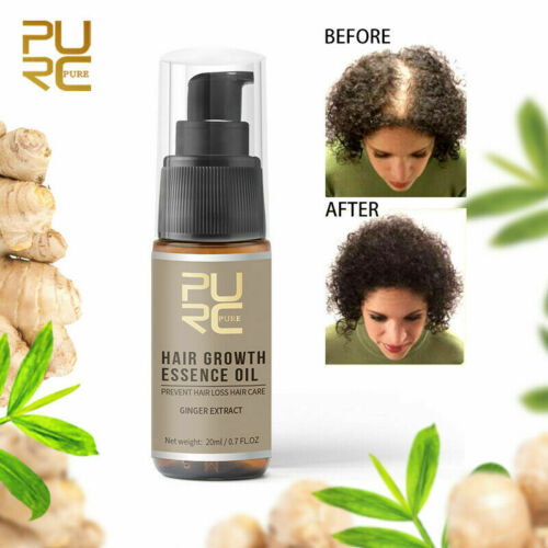Buy Natural Hair Growth Oil For Women Mens Miracle Essential Oils ...