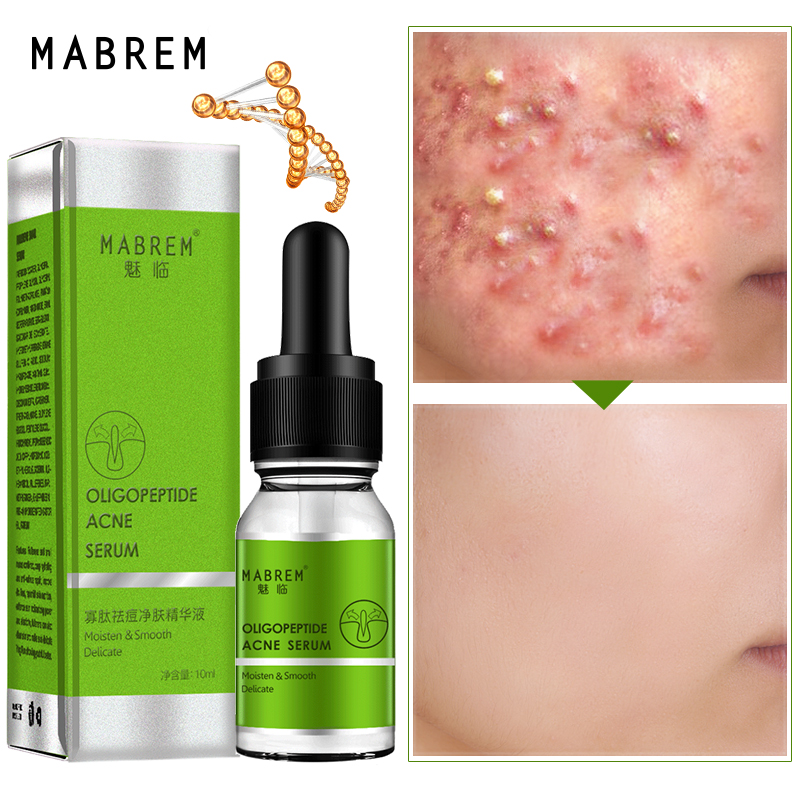 10+ Acne Lotion Serum
 PNG