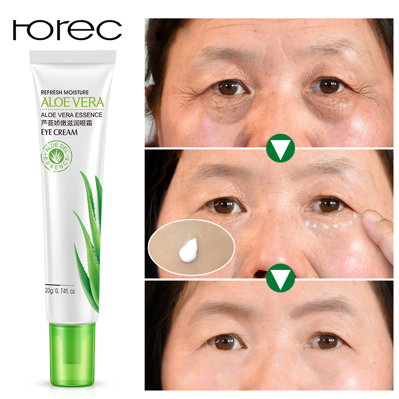 eye cream to remove bags