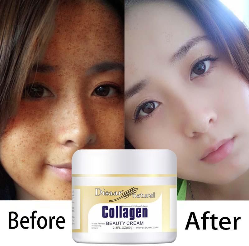 disaar collagen